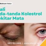 Kenali Tanda-Tanda Kolestrol Pada Mata